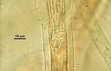 4 – Corpi iridescenti nelle cellule assiali